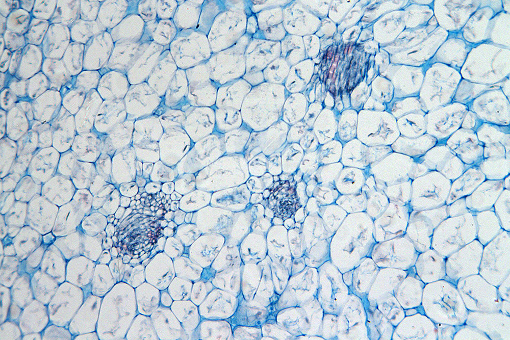 Какую клетку можно увидеть. Микропрепарат яблока под микроскопом. Мякоть Бирюсина под микроскопом. Что такое микропрепарат в биологии. Клетка кожицы томата под микроскопом.